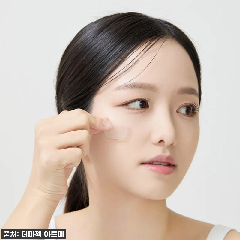 아르페 다크스팟 기미 잡티 마이크로팁 관련 이미지 1