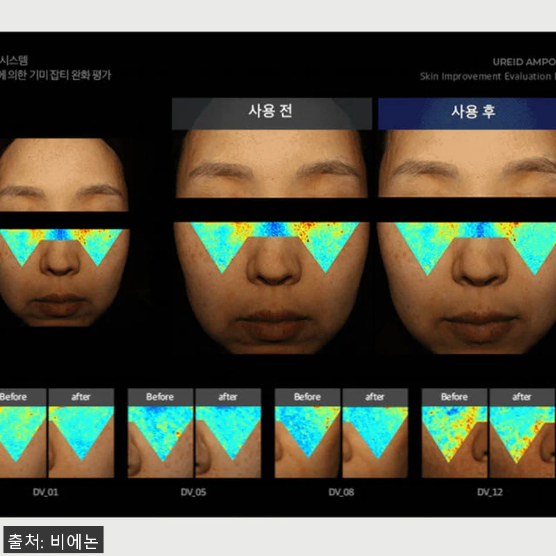 비에논 우레이드 기미앰플 사용후기: 관련 이미지 2