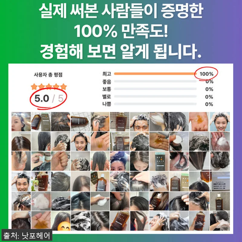 낫포헤어 지루성 두피염증 탈모 가려움 관련 이미지 2