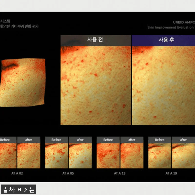 비에논 우레이드 기미앰플 사용후기: 관련 이미지 3