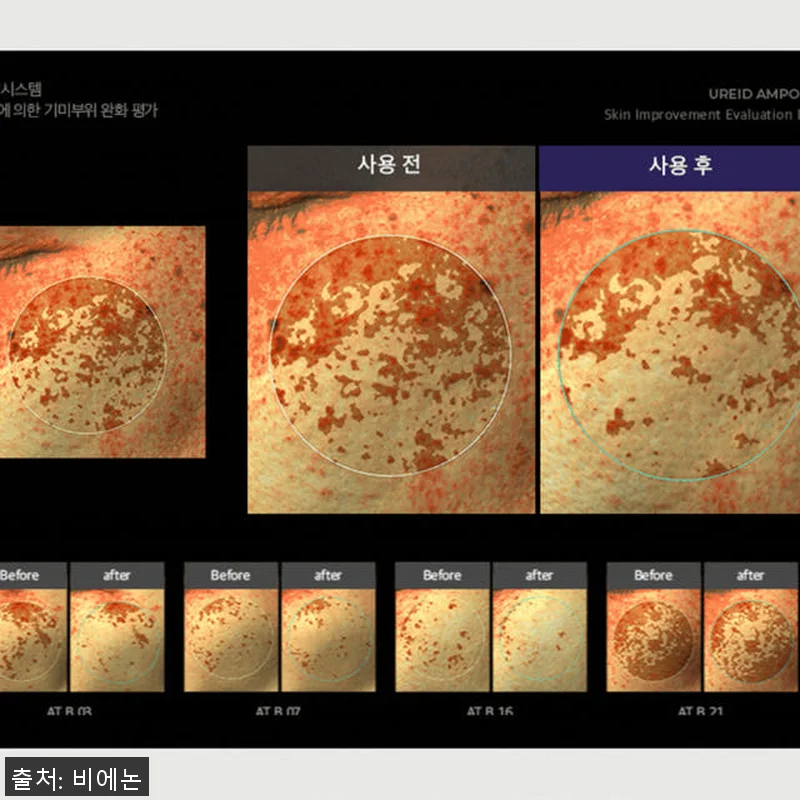 비에논 우레이드 기미앰플 사용후기: 관련 이미지 4