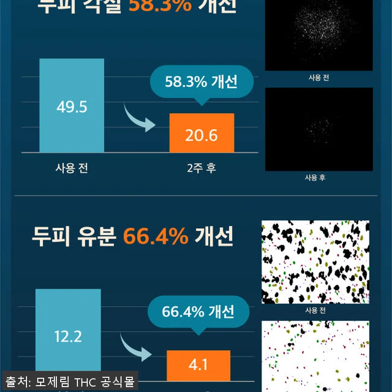모제림 엘릭서 트리트먼트 두피사용 후 관련 이미지 6