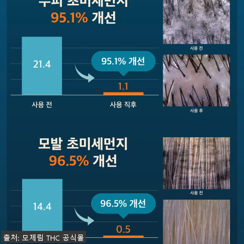 모제림 엘릭서 트리트먼트 두피사용 후 관련 이미지 7