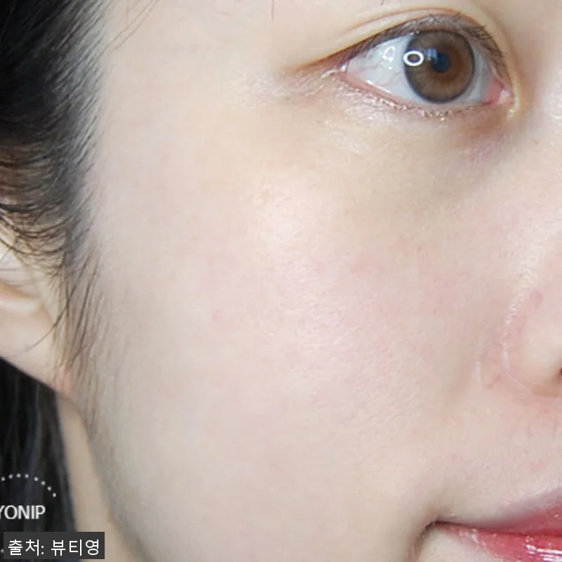 뷰티영 블랙아웃 미백크림 사용후기: 관련 이미지 6