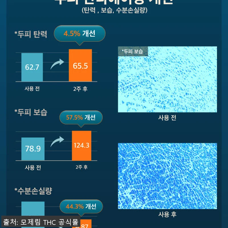 모제림 엘릭서 트리트먼트 두피사용 후 관련 이미지 9