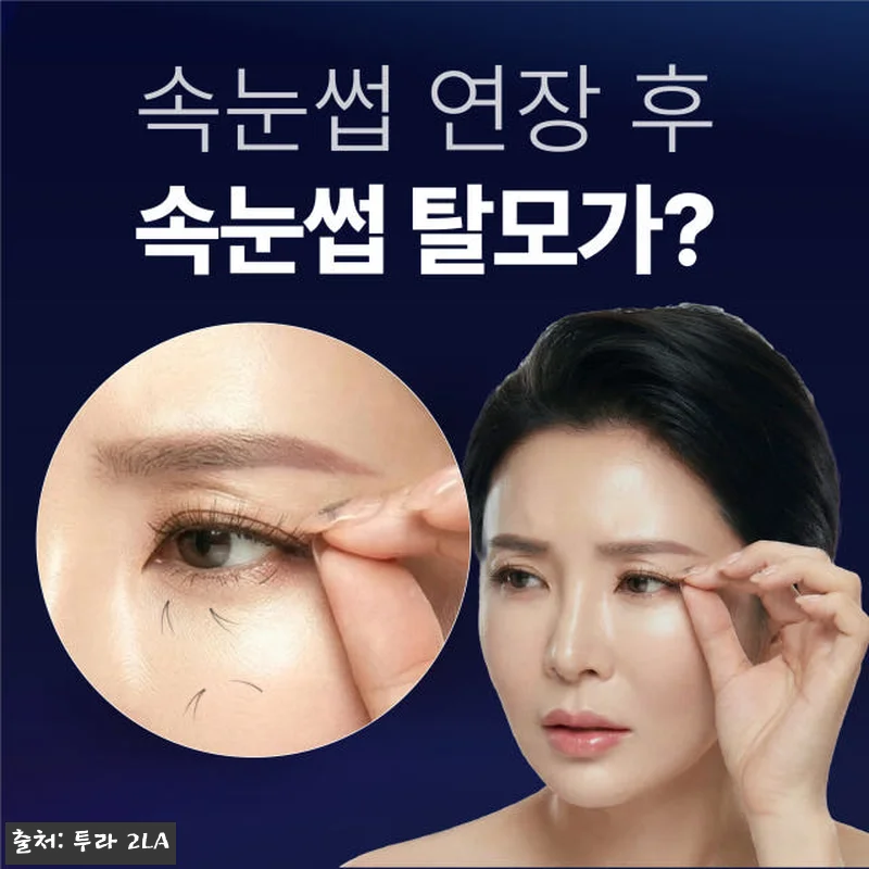 투라 리프팅 여신 속눈썹 섹시 아이 관련 이미지 2