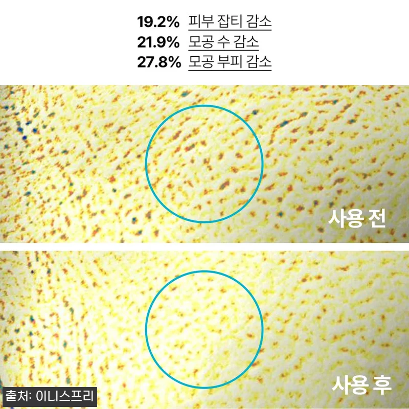 이니스프리 레티놀 시카 흔적 앰플 2 관련 이미지 4